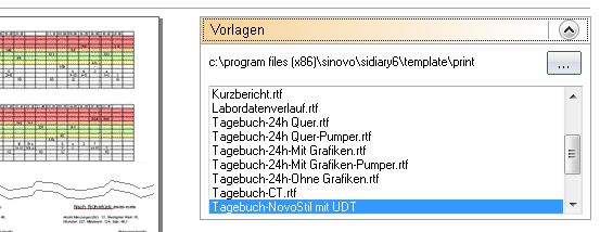 UDT-Ausdruck wählen